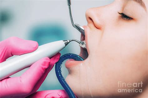 Orthodontist Cleaning Girl S Braces Photograph By Microgen Images Science Photo Library Pixels