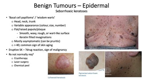 Pal Dermatology Terminology Lumps And Bumps Blisters Youtube