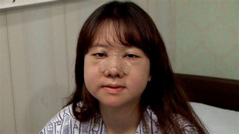 Video South Korea Plastic Surgery Inside The Growing Obsession Of