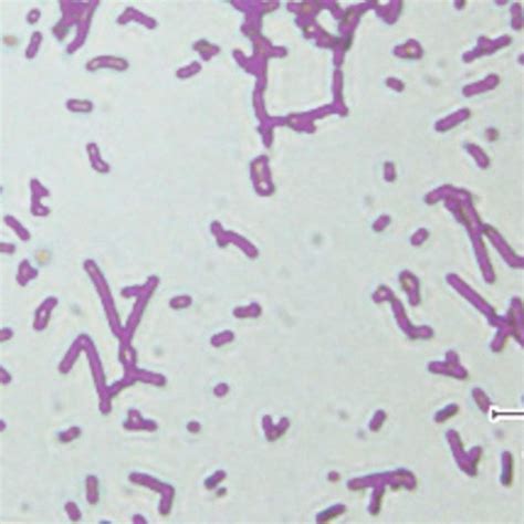 Gambar 1 Lactobacillus Sp Setelah Dilakukan Pewarnaan Gram Warna