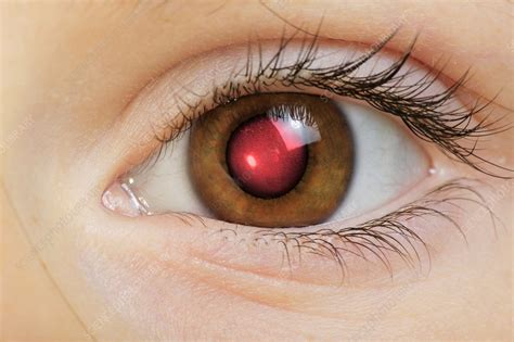 Camera Flash Red Eye Stock Image P4200550 Science Photo Library