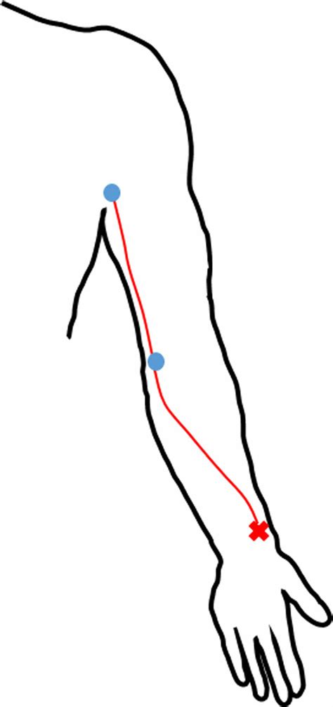 The Red X Marks The Injection Site Of The Contrast Agent Blue Dots