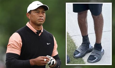 Tiger Woods Full Injury Revealed As Golf Fans See Icons Huge Leg Scar