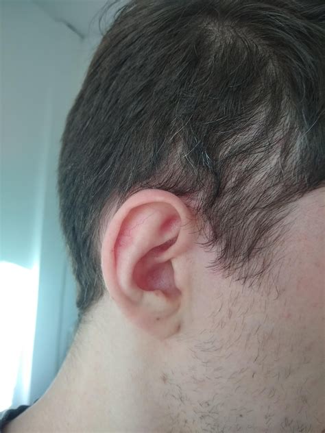Is This Amount Of White Hair Normal Or Is My Hair Turning White Already