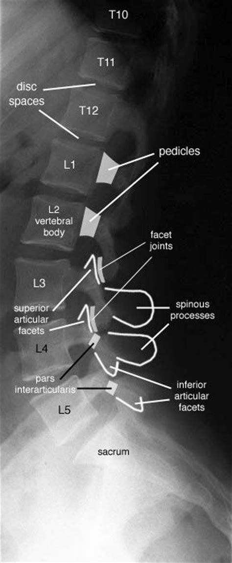 The central ray is perpendicular to the image. Lumbar spine and coccyx X-ray diagram