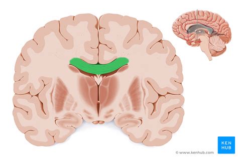 Coronal View Ventricles Brain Diagram Corpus Callosum Brain Anatomy My Xxx Hot Girl