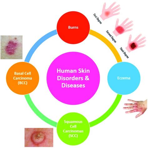 Skin Conditions And Diseases That Might Appear During The Life Cycle Of