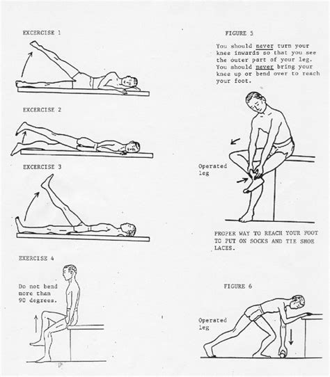 Hip Replacement Exercises After Weeks Exercise