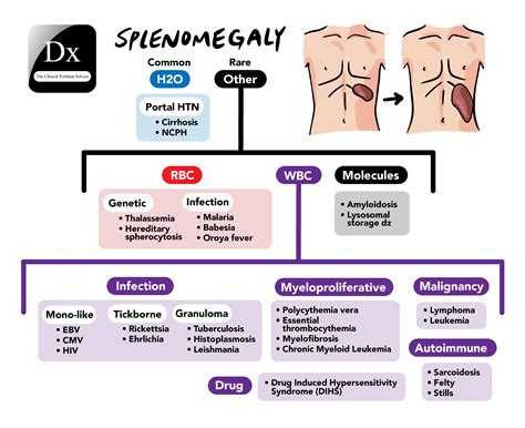 Splenomegaly Schema 3 Page 001 The Clinical Problem Solvers
