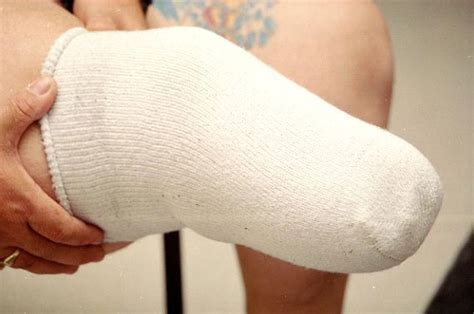 Law Comfort Prosthetic And Orthotic Socks And Tubes