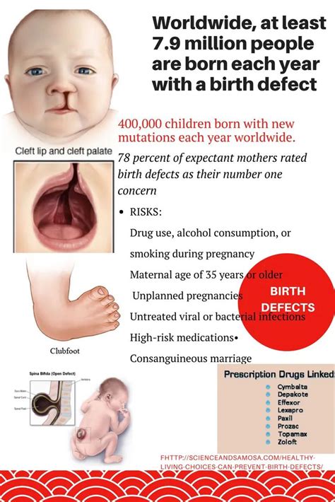Healthy Living Choices Can Prevent ‘birth Defects Birth Cleft Lip