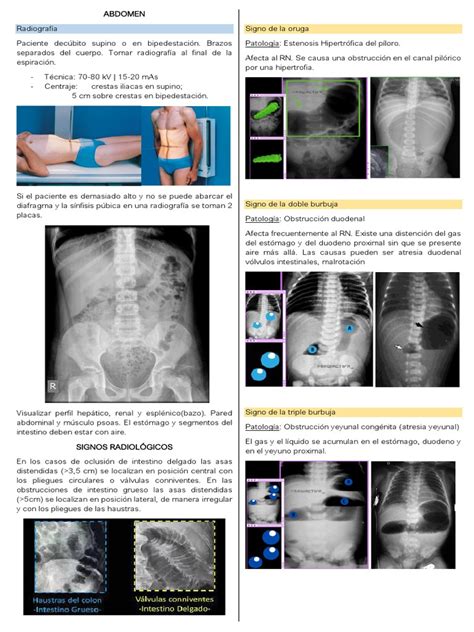 Radiografía Abdominal Signos Radiológicos De Obstrucción Intestinal