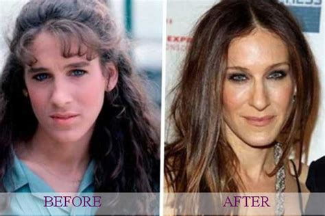 Sarah Jessica Parker Plastic Surgery Nose Job Botox After And Before