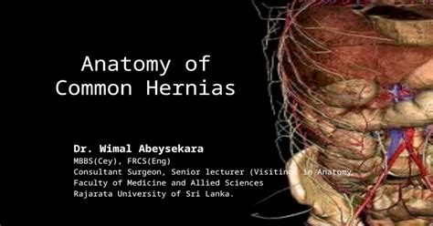 Anatomy Of Common Hernias Ppt Powerpoint