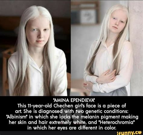 Amina Ependieva This 11 Year Old Chechen Girls Face Is A Piece Of Art She Is Diagnosed With