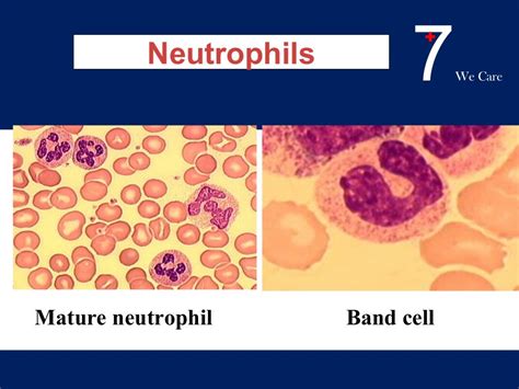 Neonatal Sepsis Dr Trynaadh