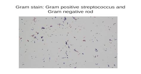 Gram Stain Gram Positive Streptococcus And Gram Negative Rod Ppt