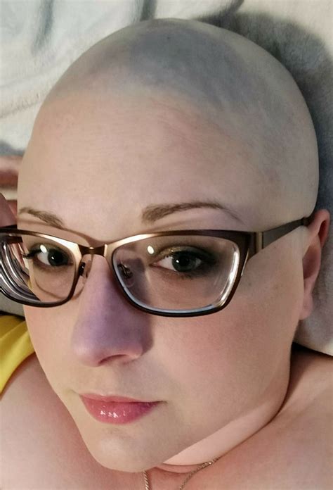 Woman Bald Head Shave Whittleonline