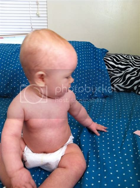 Does Your Babies Head Indent Pics Babycenter