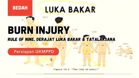 Burn Injury Derajat Luka Bakar Rule Of Nine Baxter Formula Youtube