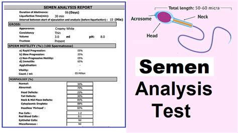 semen analysis test made easy to understand helal medical
