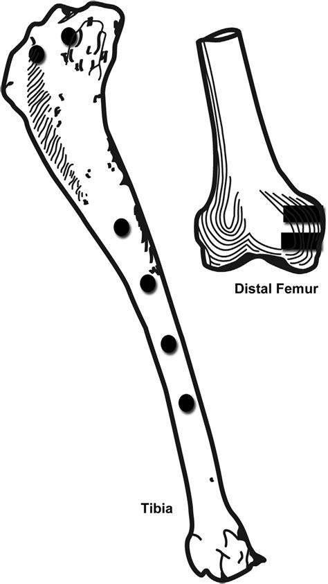 Detailed Schematic Of Implant Positions In The Tibial Diaphysis
