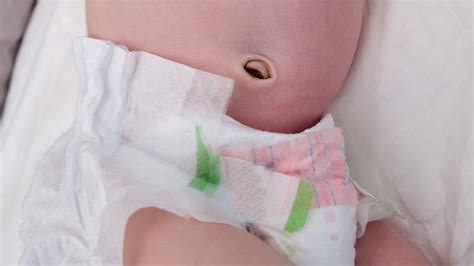 Entfernt Definieren Verwischen Belly Button Discharge During Pregnancy Stadtzentrum Verbrechen Sache