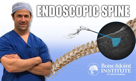 Performs The First Endoscopic Spine Surgery In The Us With The New