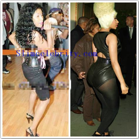 Nicki Minaj Before And After Plastic Surgery Terrys Blog
