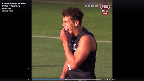Curnow Pulls Out His Teeth