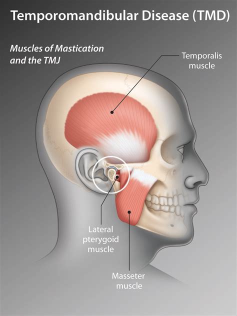Temporomandibular Joint Disorders Pictures