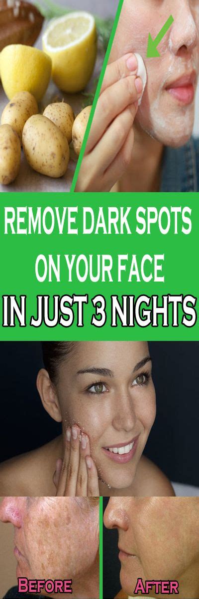 Remove Dark Spots On Your Face In Just 3 Nights Dark Spots On Face