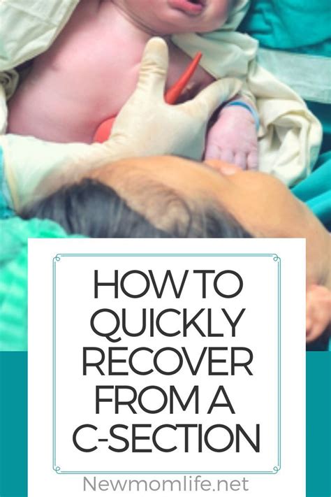 20 C Section Recovery Tips C Section Recovery C Section Recovery Timeline Postpartum Recovery