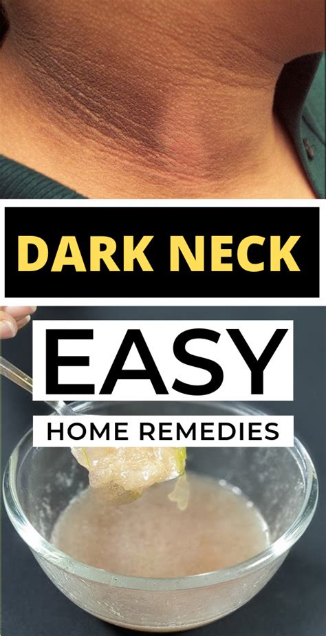 Home Remedies That You Must Try To Get Rid Of Dark Skin Around Your