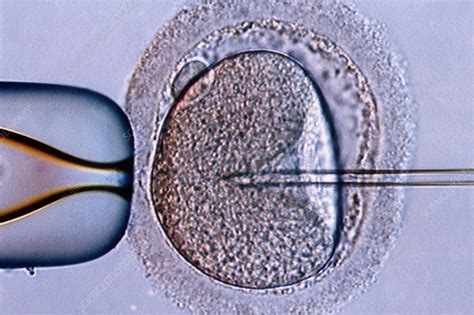 in vitro fertilization stock image c030 9242 science photo library