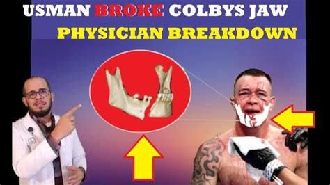 Doctor Breakdown Of Colby Covington Broken Jaw At Ufc 245 Ufc 245