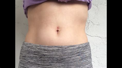 Belly Button Piercing After Taking Out