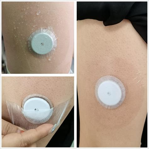 Pack Freestyle Libre Sensor Covers Latex Free Medical Adhesive Patches For Libre Precut Cgm