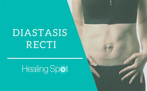 Working on the strategies your body uses to move will help prevent doming and bulging at the surgery site. Diastasis Recti: What Is It and How Do You Heal It? - The ...