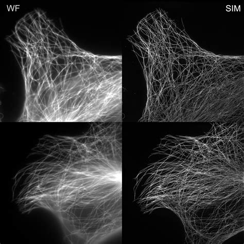 Sim Hms Super Resolution Microscopy In The Department Of Cell