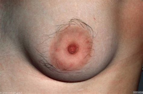 Hairy Female Nipple Pics Mentortijd