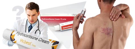 Can I Use Hydrocortisone Cream On Shingles Rash Internationaldrugmart