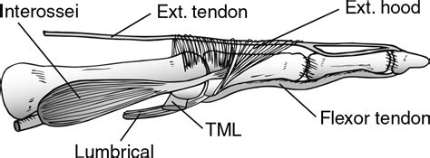 Etiology And Management Of Lesser Toe Metatarsophalangeal Joint