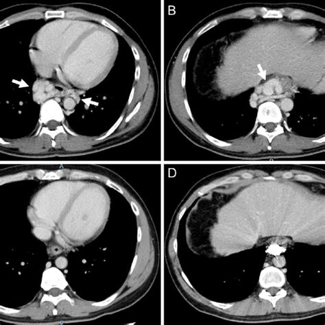 Figure1a B Dynamic Contrast Enhanced Computed Tomography Ct