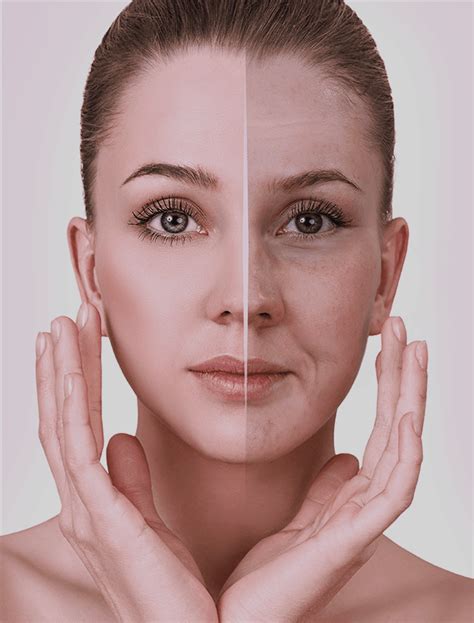 Skin Rejuvenation Dermal Therapy Face To Face Medical