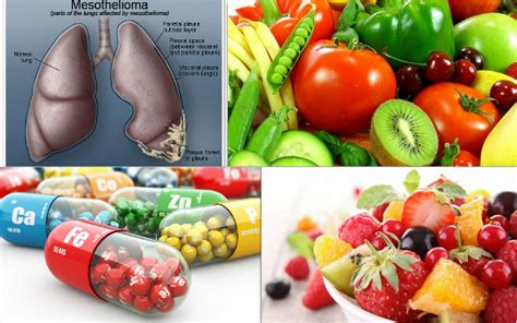 Vitamins And Minerals For Mesothelioma Cancer Natural Fitness Tips