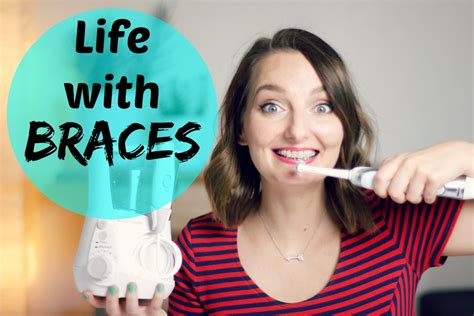 Life With Braces My Experience And Helpful Tips Youtube