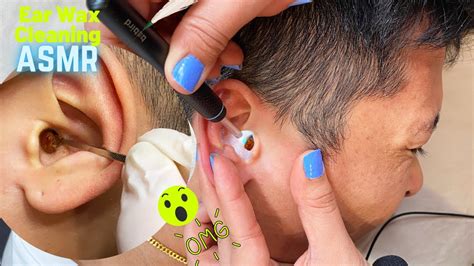 Asmr Worldss Greatest Ear Cleaningprofessional Ear Cleaning