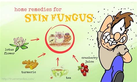 21 Home Remedies For Skin Fungus On Hands Thighs And Legs