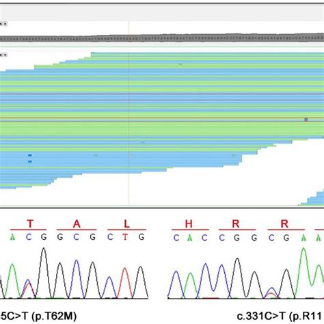 Wes And Sanger Sequencing Results A A Compound Heterozygous Variants Download Scientific
